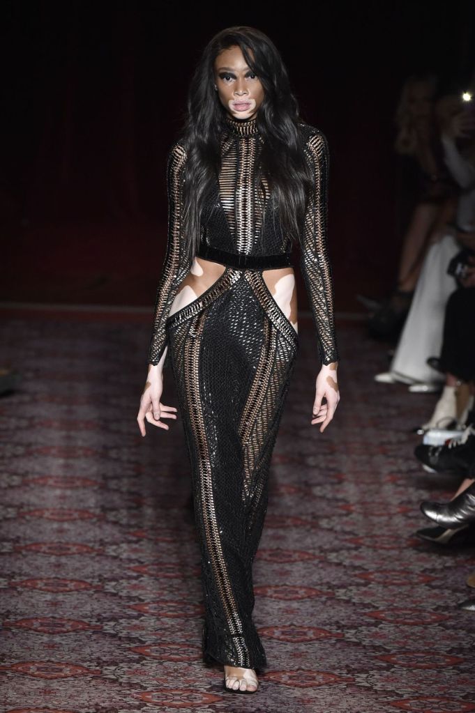Winnie Harlow showing off her skin condition (vitiligo) in Julien Macdonald AW17. 